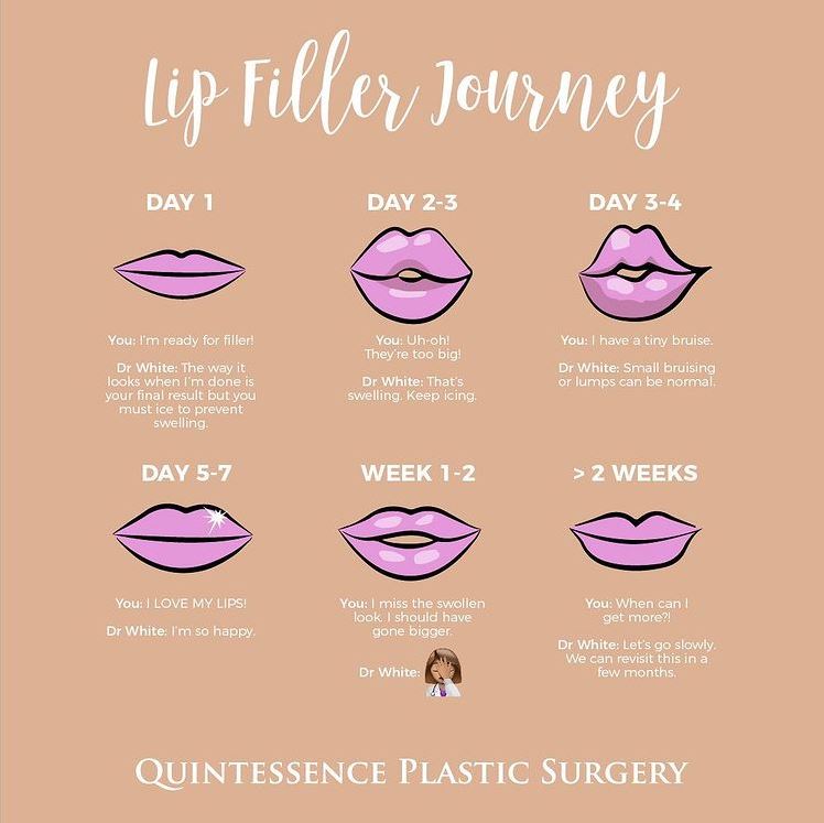 Dr. White helps her patients through their lip filler journey