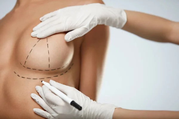 What’s the Breast Workout After Breast Augmentation?